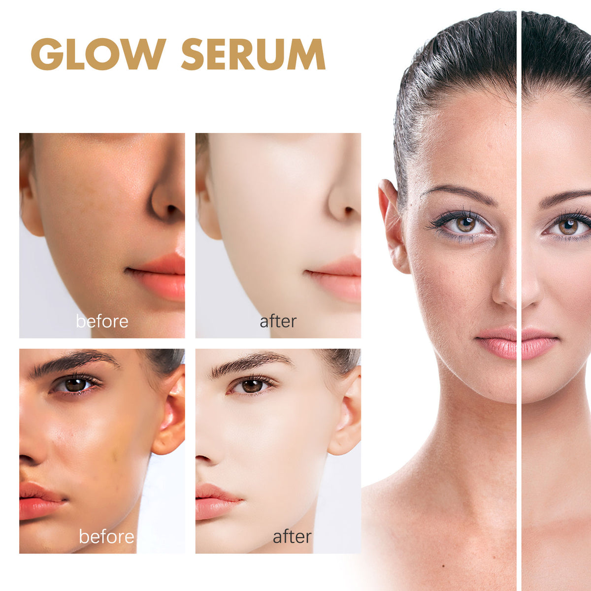 EELHOE Propolis & Nicotinamide Brightening Essence | Reduce Acne Marks, Moisturize & Whiten