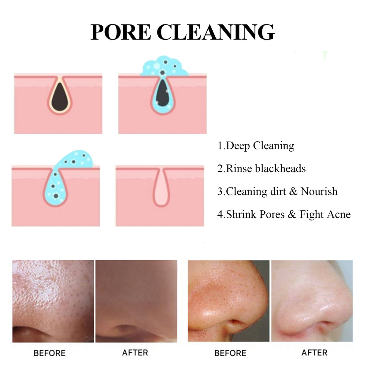 EELHOE Blackhead Removal Mask | Deep Pore Cleansing, Oil Control & Moisturizing Peel Mask