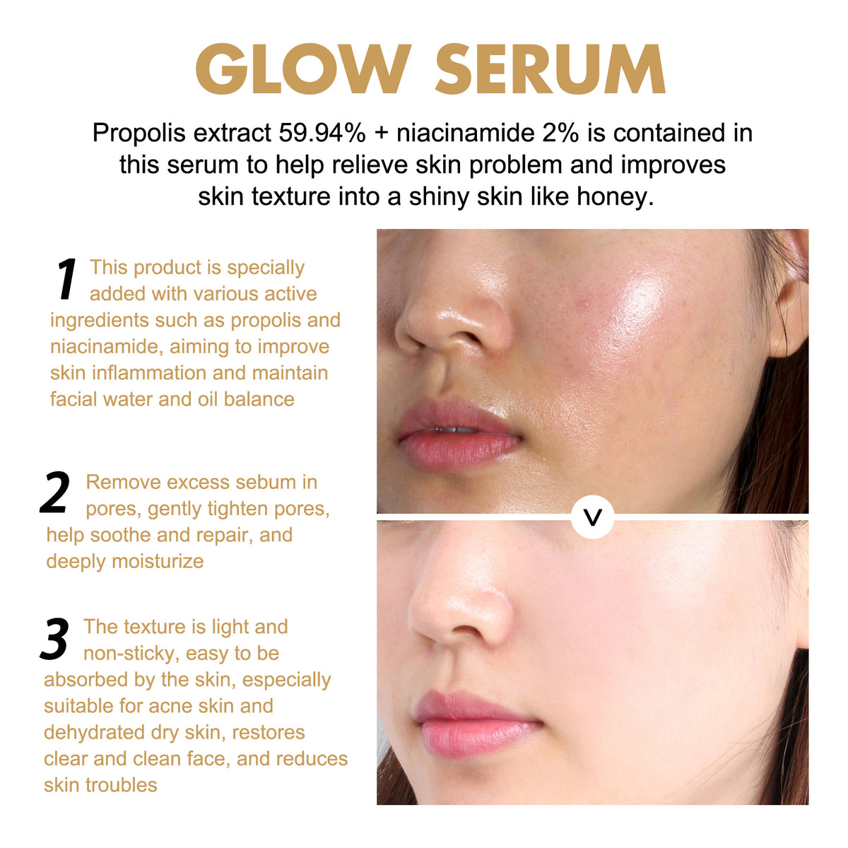 EELHOE Propolis & Nicotinamide Brightening Essence | Reduce Acne Marks, Moisturize & Whiten